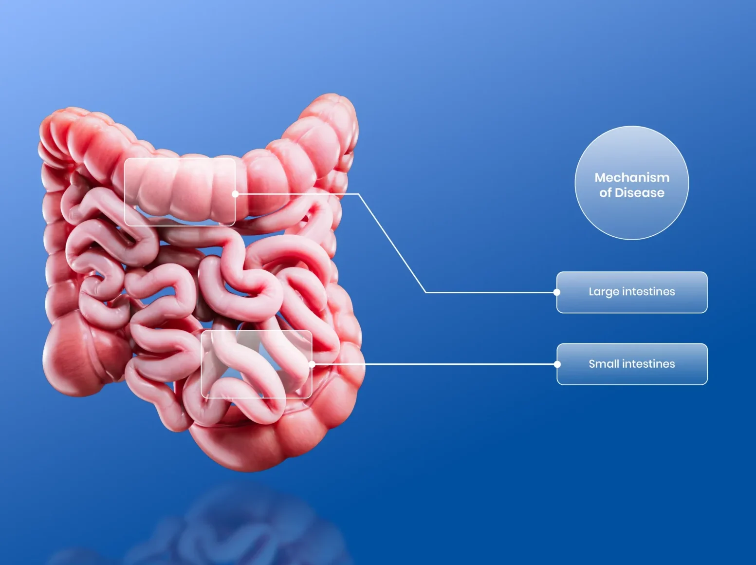 disease-education-mechanism-of-disease-gut-animation