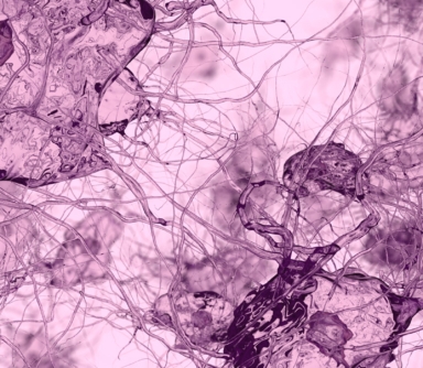 3D model of osteocytes designed by Random42