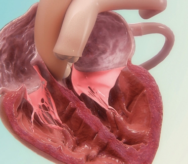 3D model of heart designed by Random42
