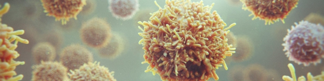 3D model of cancer immunotherapy designed by Random42