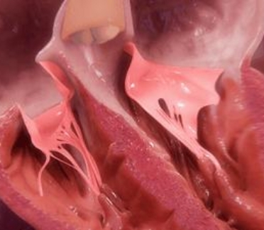 3D model of a heart designed by Random42