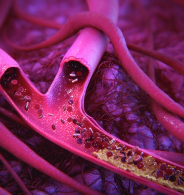 3D model of a blood vessel normal stent designed by Random42