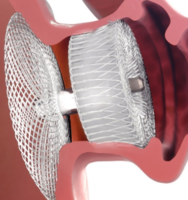 3D model of amulet appendage designed by Random42