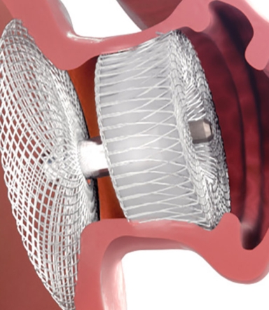 3D model of amulet appendage designed by Random42