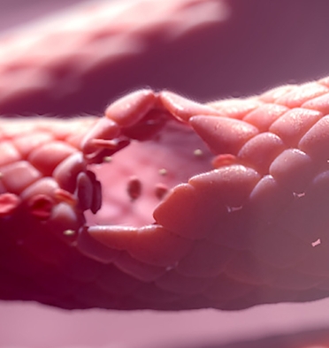 3D model of Von Willebrand Disease designed by Random42