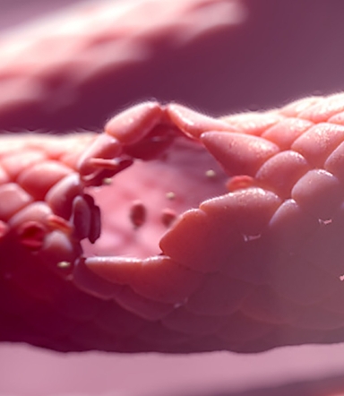 3D model of Von Willebrand Disease designed by Random42