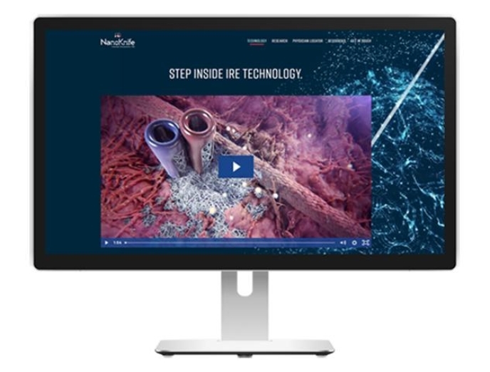 Electroporation Medical Device Animation