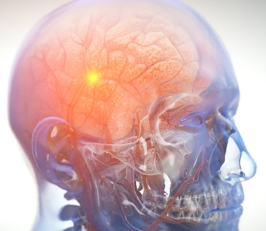 Traumatic Brain Injury Animation