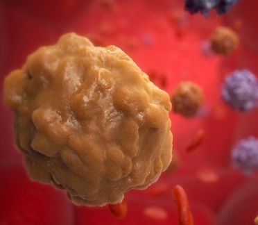 Hematologic Malignancies Interactive Game
