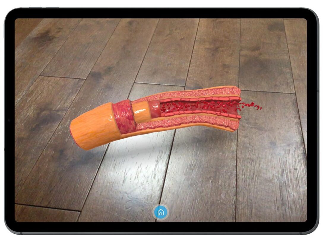 Augmented reality for ASH 2023