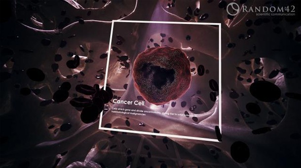 3D model of cancer cell designed by Random42