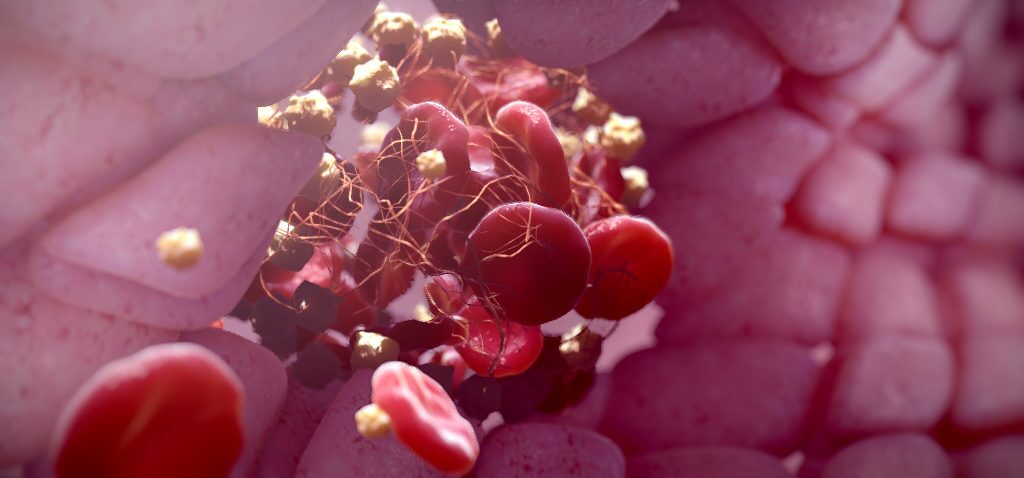 3D model of a blood vessel designed by Random42