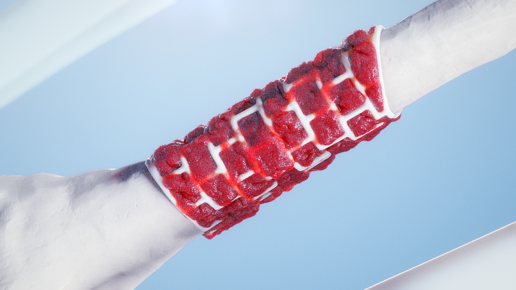 Bone Surgery Scientific Animation