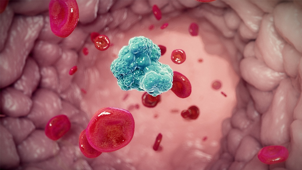 Aspirin Mechanism of action Animation