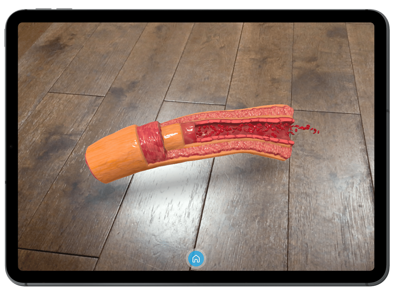 Augmented reality for ASH 2023