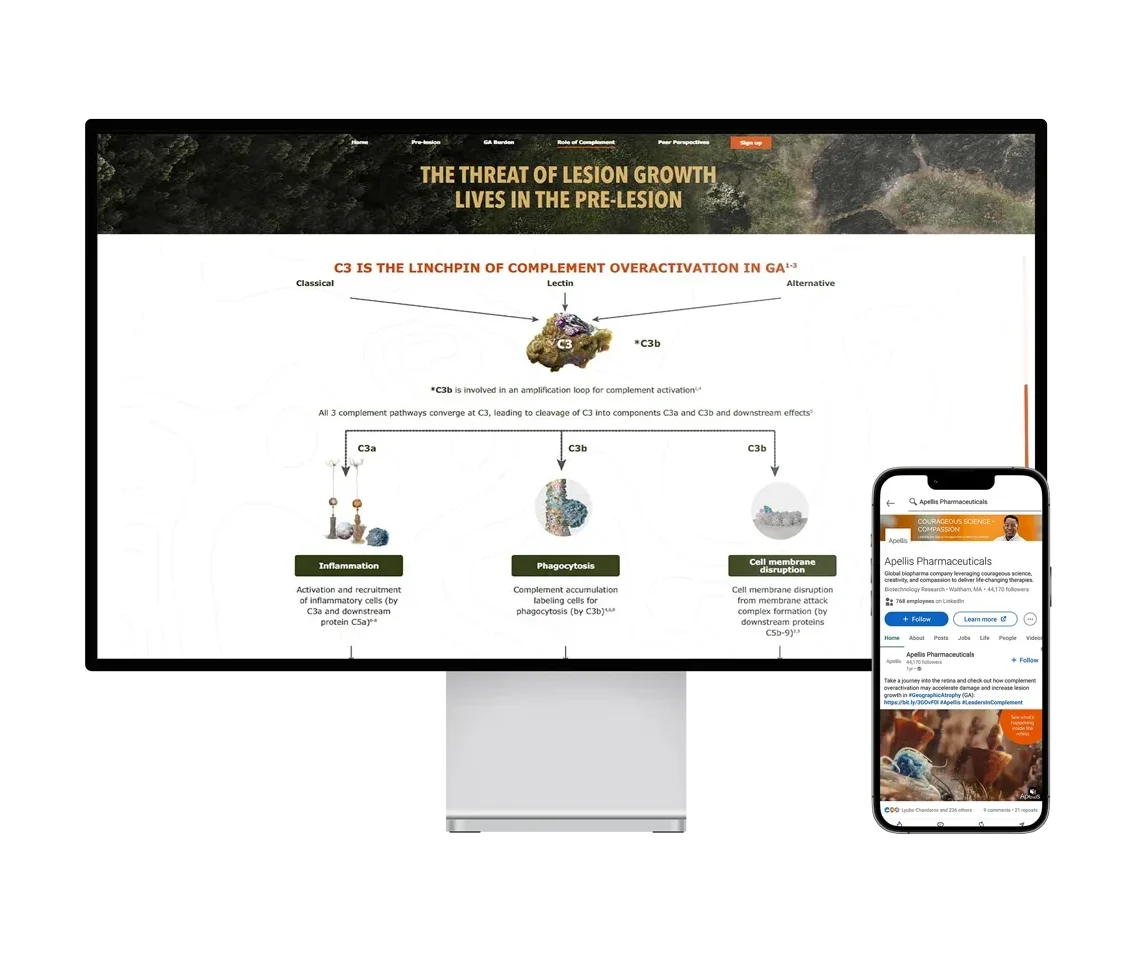 medical animation showing mod of geographic atrophy