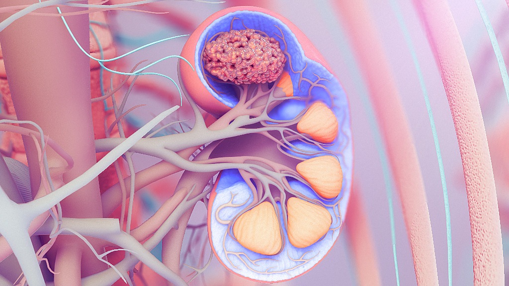3D medical animation showing kidney for biotech investors