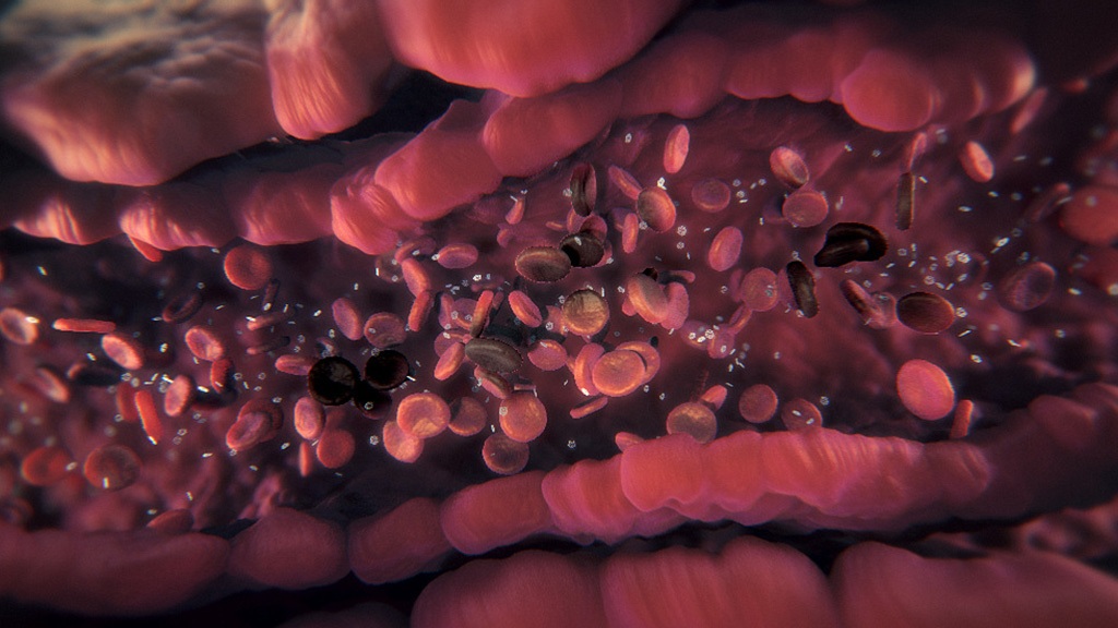 3D model of a blood vessel designed by Random42