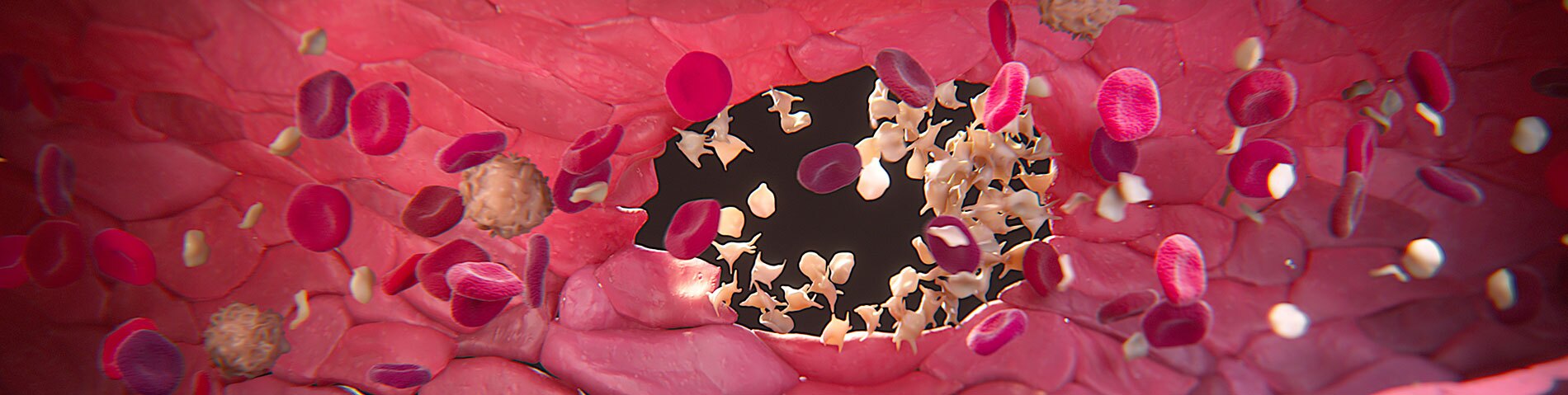 3D model of hematology designed by Random42