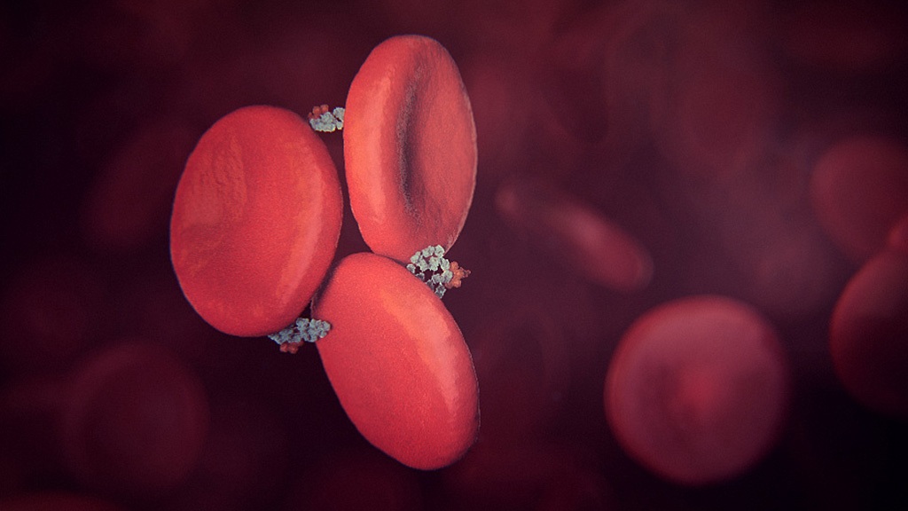 3D model of hematology designed by Random42