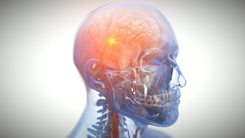 Traumatic Brain Injury MoA
