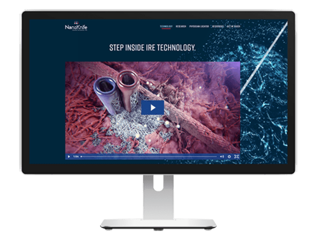 Electroporation Medical Device Animation