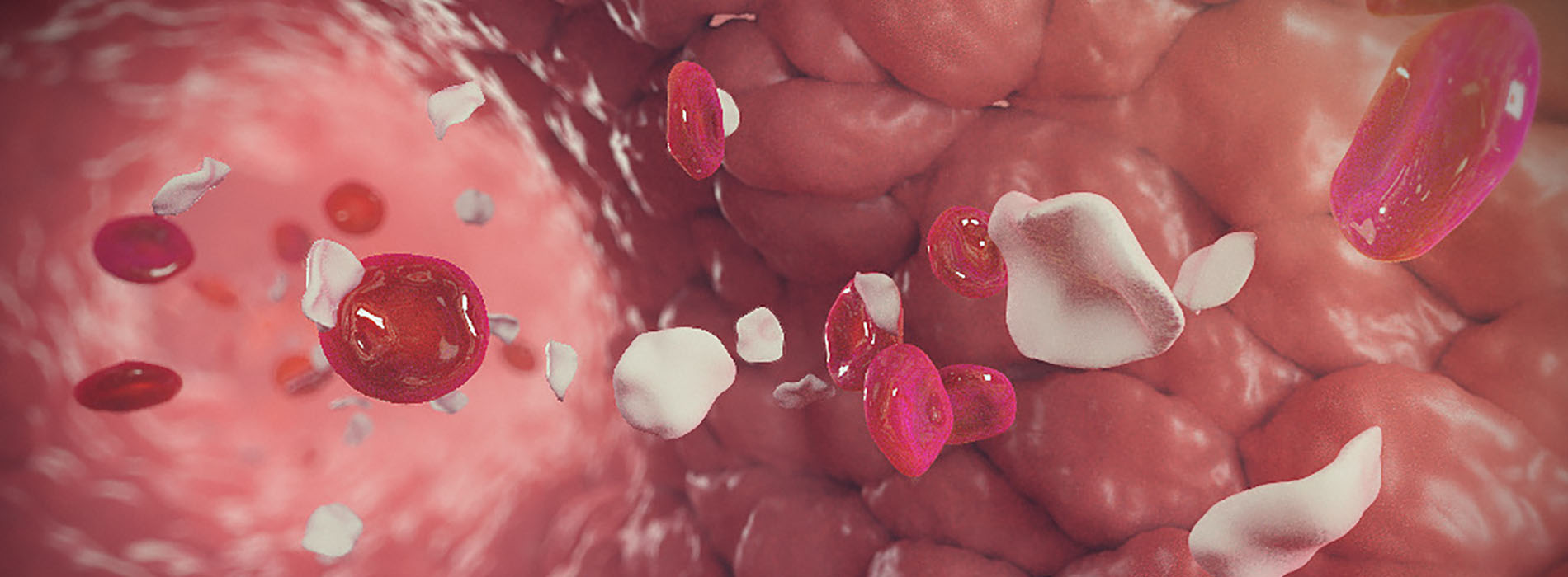 3D model of BV platelets designed by Random42