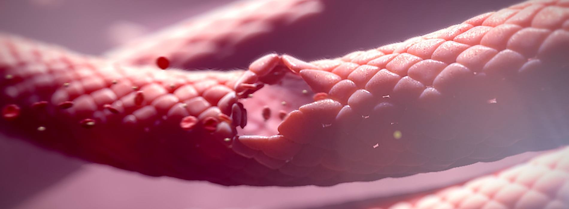 3D model of Von Willebrand Disease designed by Random42