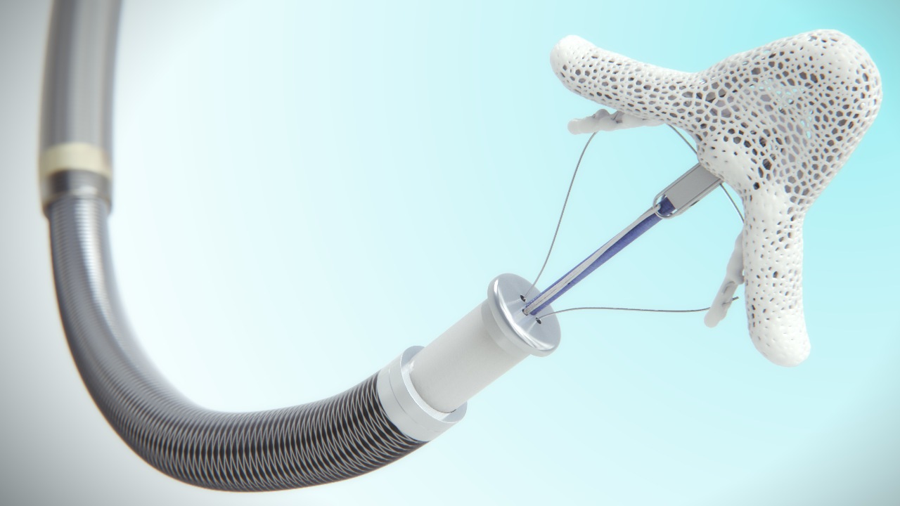 Mitral Valve Repair Scientific Animation