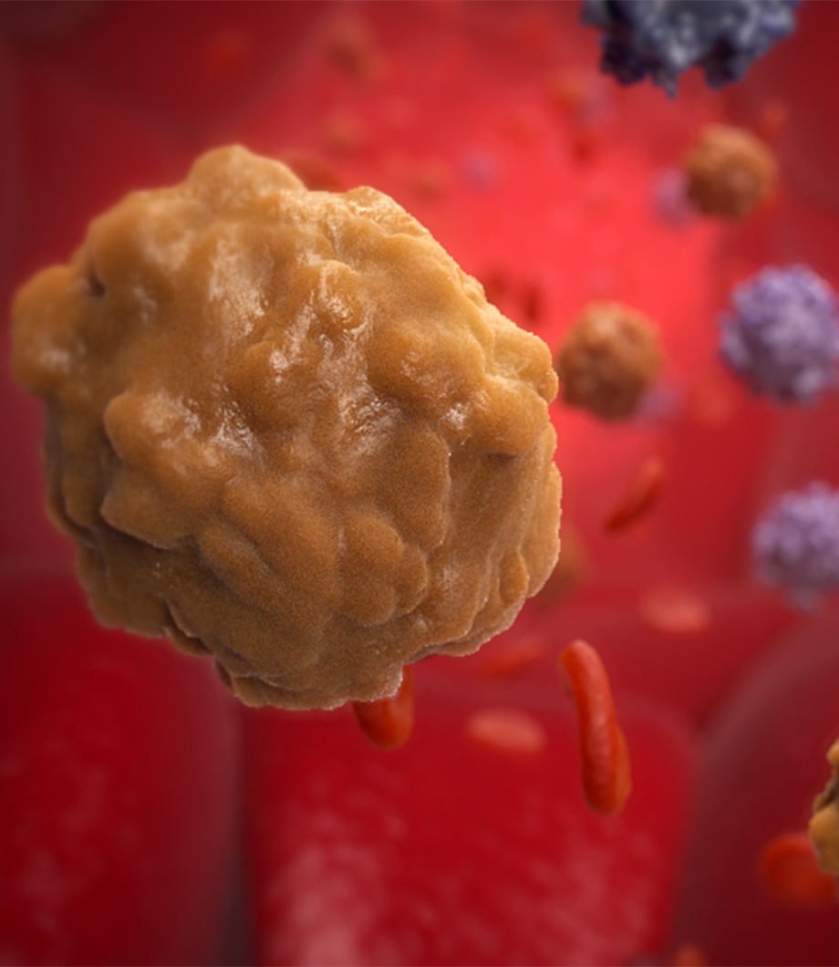 Hematologic Malignancies Interactive Game