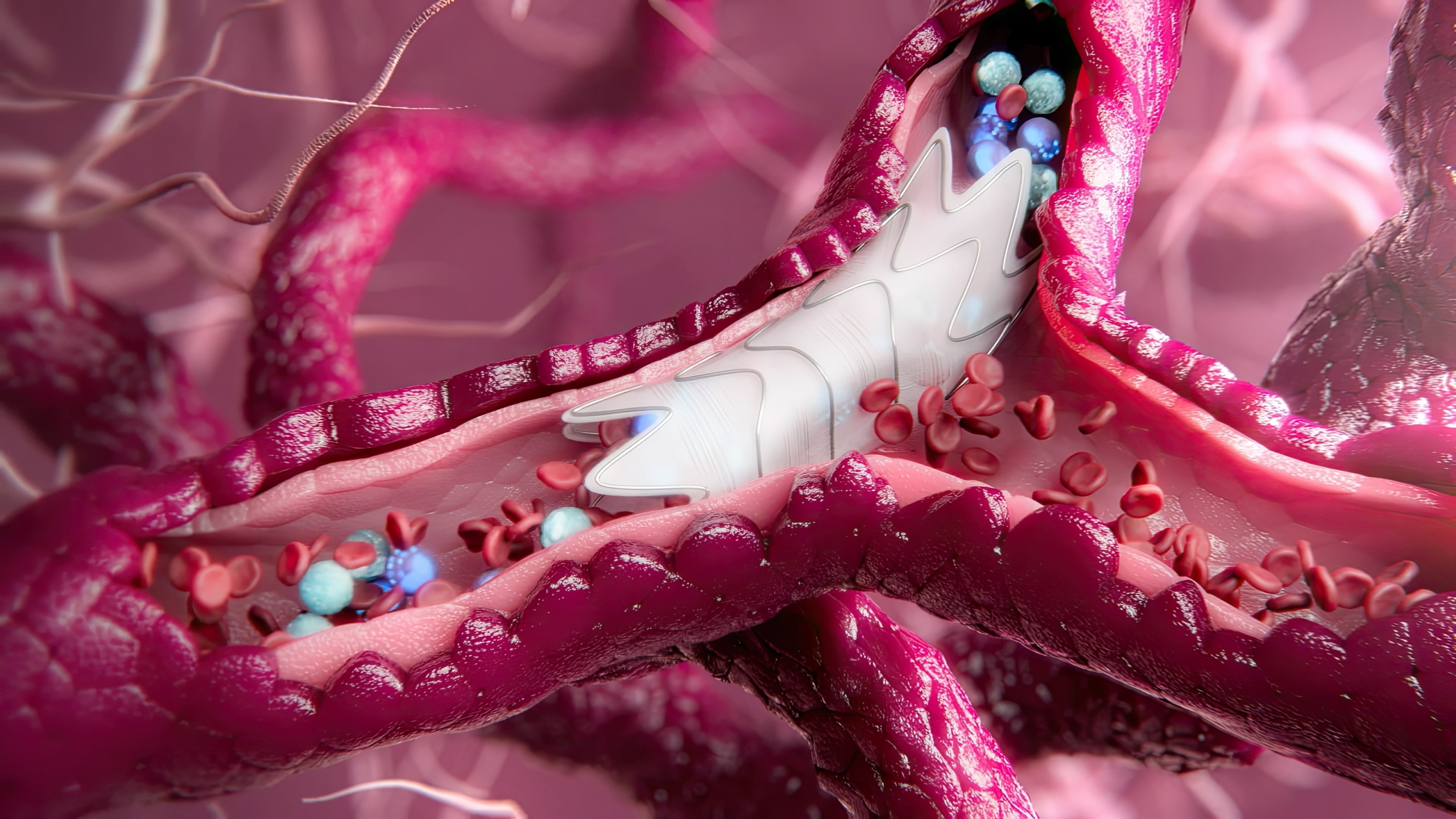 Medical Device Animation