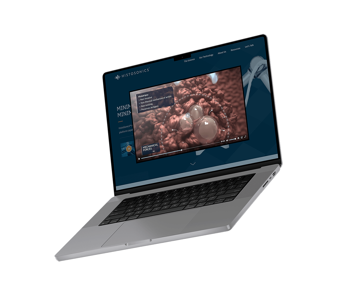 Histotripsy platform animation