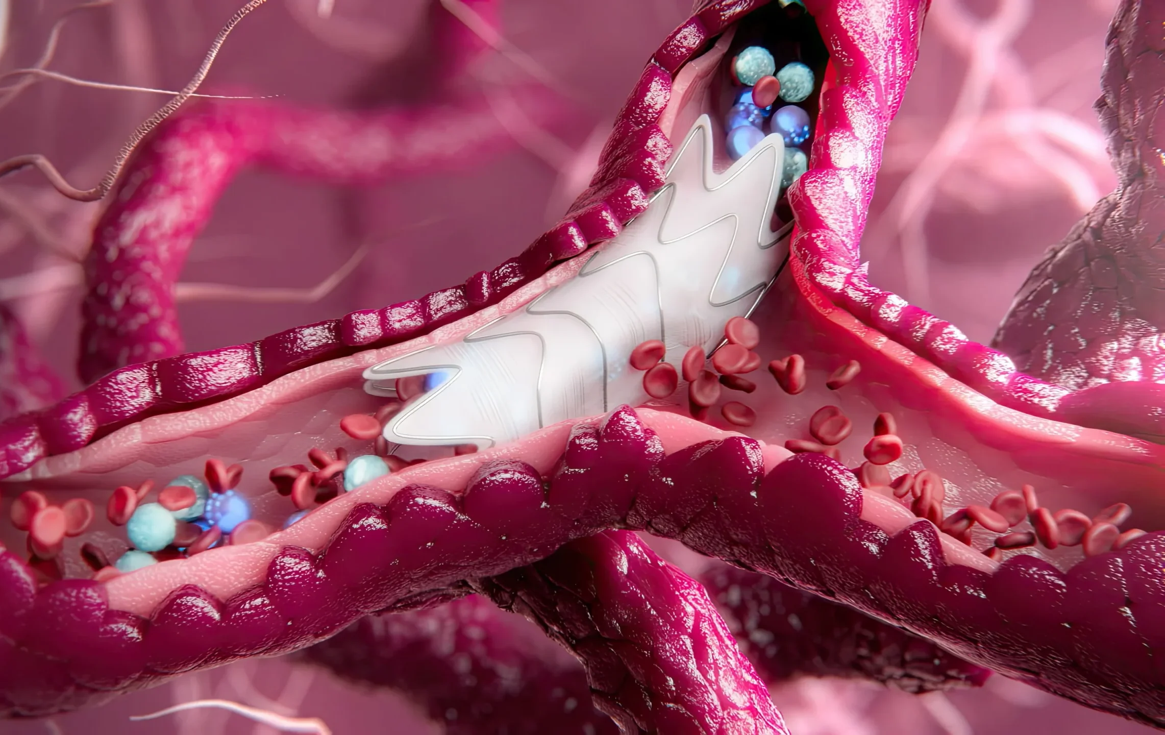 Random42 Medical Device Animation