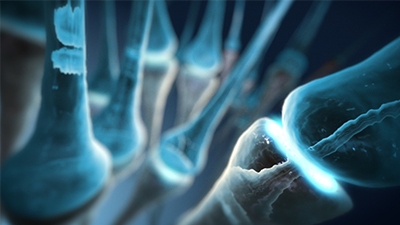 3D model of autonomic regulation therapy designed by Random42