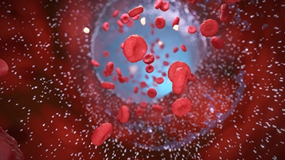 3D model of Drug Coated Balloon designed by Random42